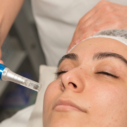 Look Anzhela Est&eacute;tica 3